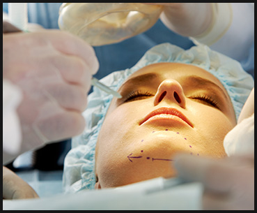 Facial Implant Surgery